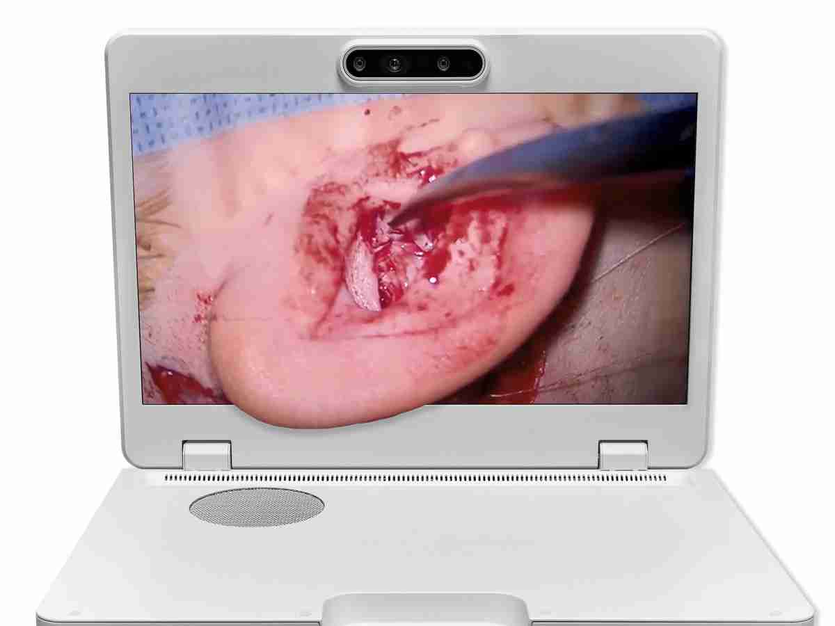 达擎之＂Heads-up 3D显微手术显示系统＂，，，整合4K裸眼3D显示及眼球追踪系统，，，，具备快速追踪人眼移动位置功能，，，减轻医师长时间维持固定姿势的负担，，，让医师能有更宽广清晰的3D立体视野及更舒适的姿势来执行手术。。